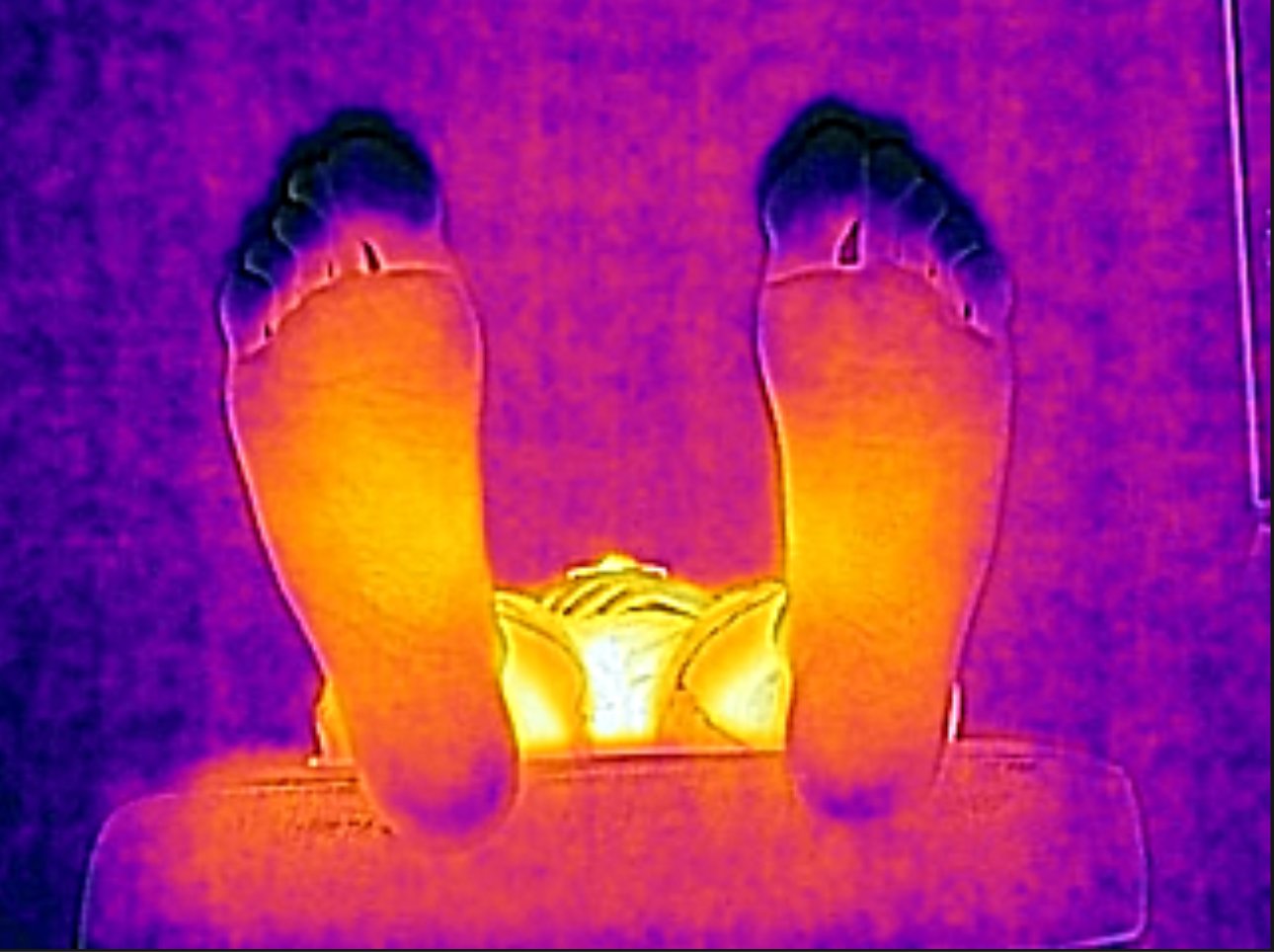 Feet thermal picture example 1.